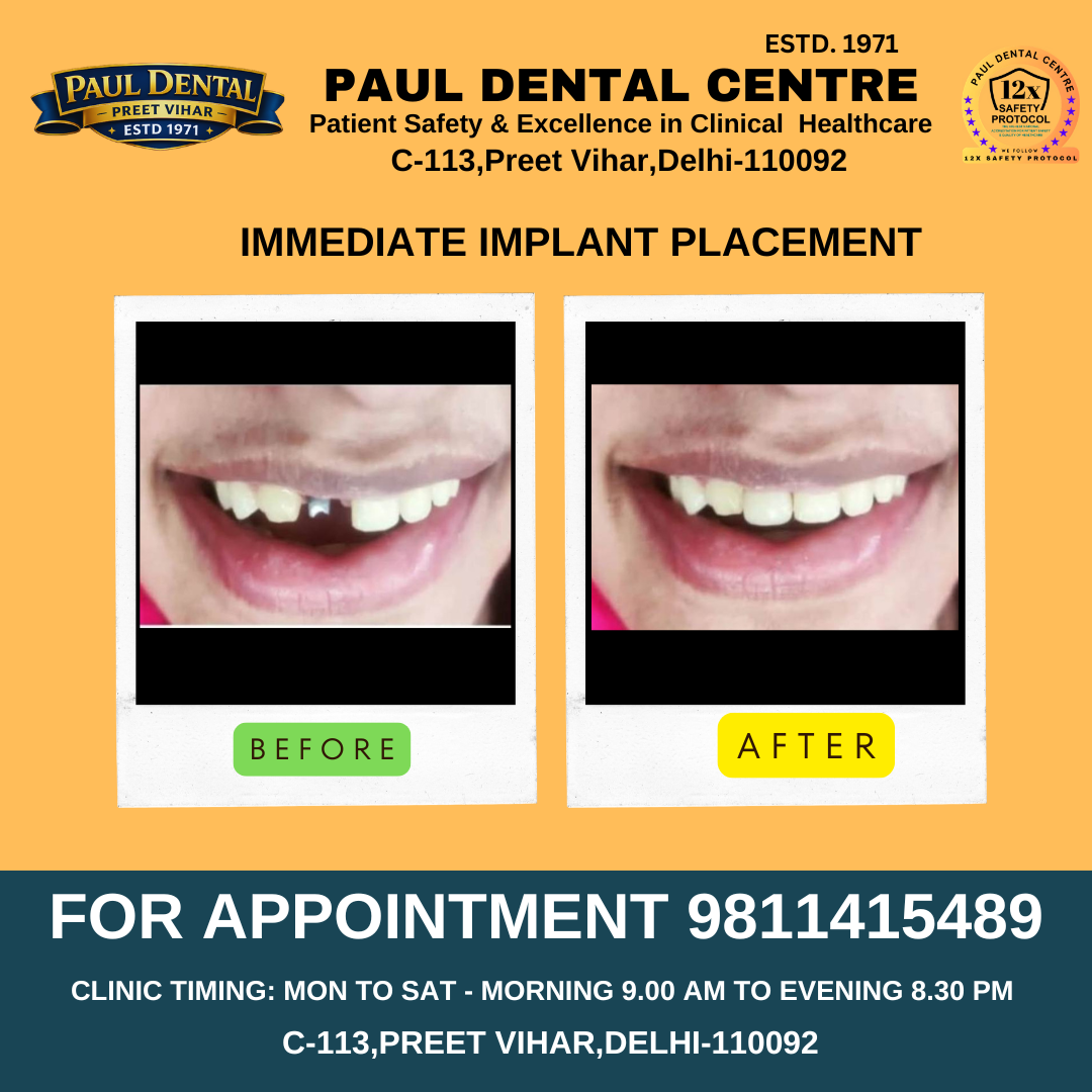 Case 32 – Paul Dental Center